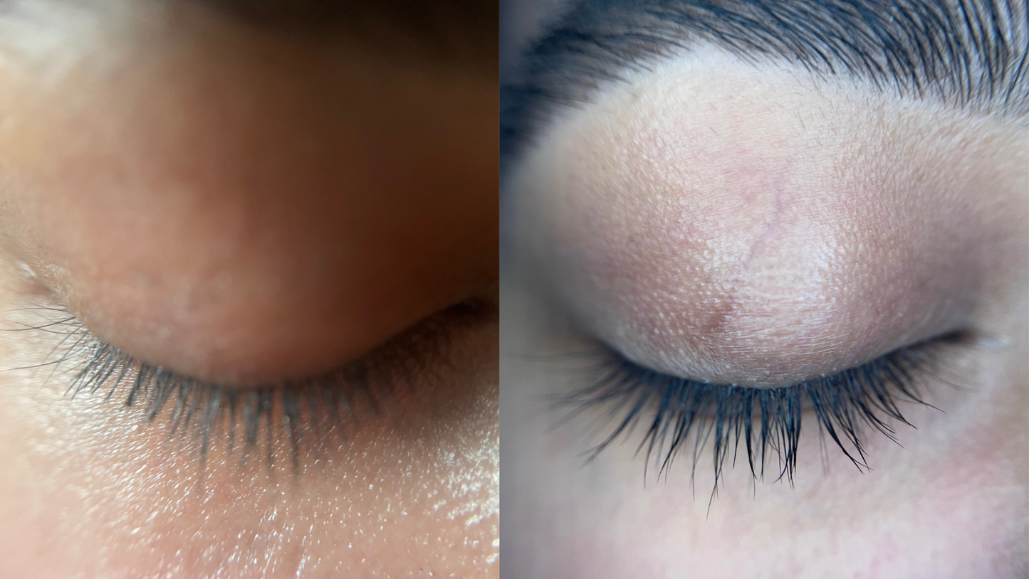 Eyelash Serum